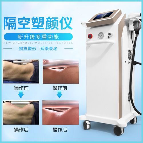 特價溶脂瘦身 碎脂機(jī)